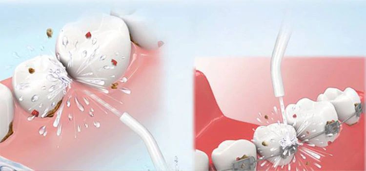Irigator bucal pentru curatare dentara Power Floss