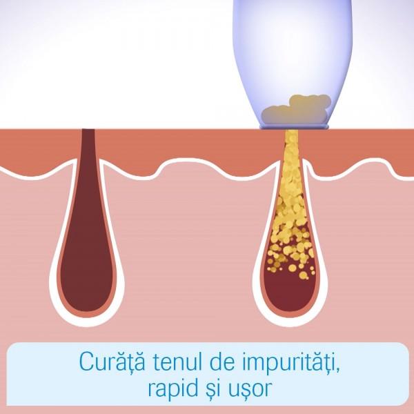 Aspirator facial, pentru un ten curat